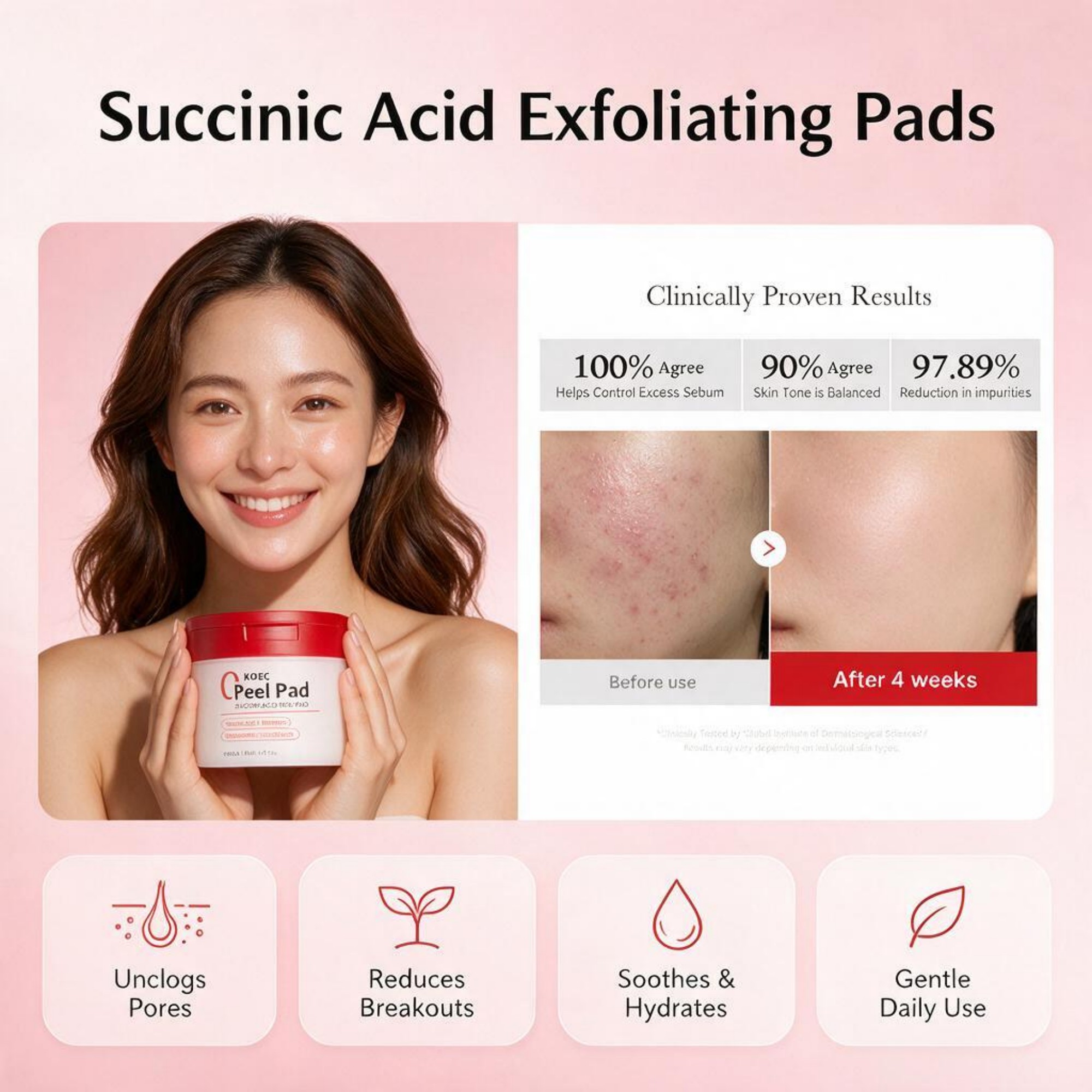 Skincare Non Comedogenic - 2026年新発売 レッドサクシニック酸＆パンテノール配合 フェイシャルピーリングトナーパッド、AHA・BHA・ナイアシンアミド配合の優しい角質除去スキンケアパッド、ニキビや肌荒れが起こりやすい肌のための鎮静・緩和効果のあるノンコメドジェニックトリートメント、心のこもったバレンタインデーギフト