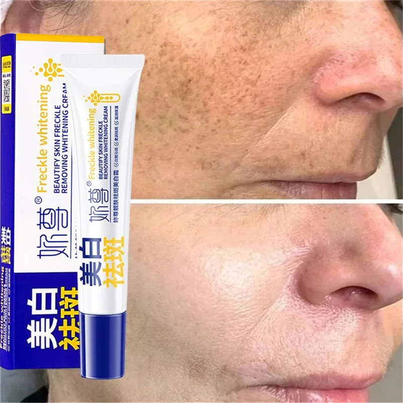 強力なシミ取り美白クリーム 肌を素早く明るくする メラニン色 - Skincare Korea のレビューと価格