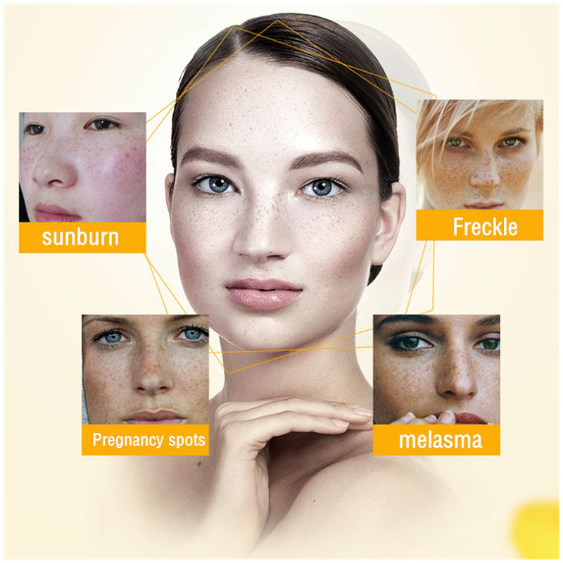 Dimollaure 美白そばかすクリーム保湿引き締め抗しわ - Skincare Korea のレビューと価格