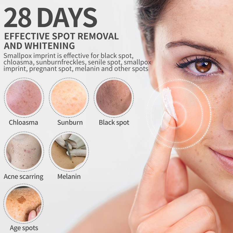 Dimollaure 美白そばかすクリーム保湿引き締め抗しわ - Skincare Korea のレビューと価格
