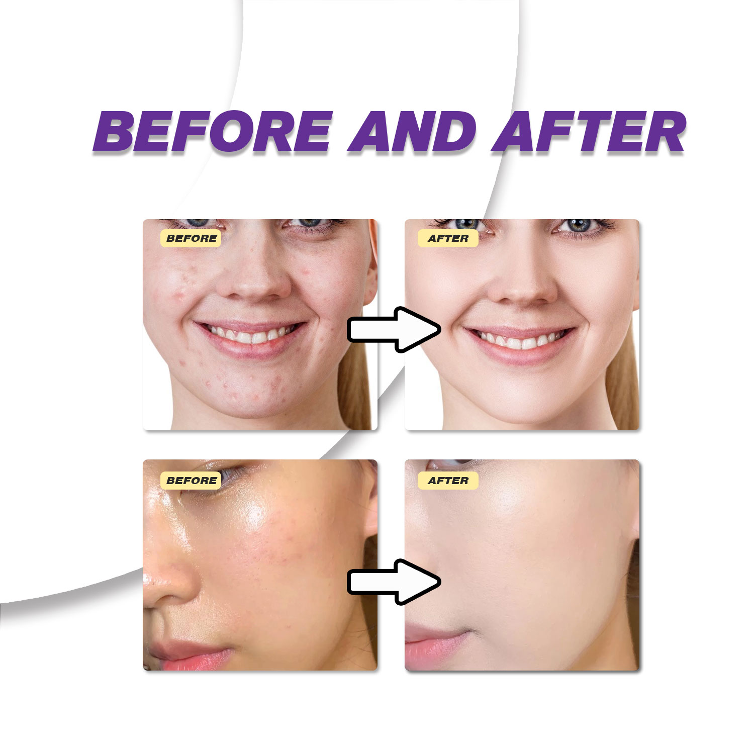 マイルドなアゼライン酸クリームは、くすんだ肌を改善し、荒れた - Skincare Skintific のレビューと価格