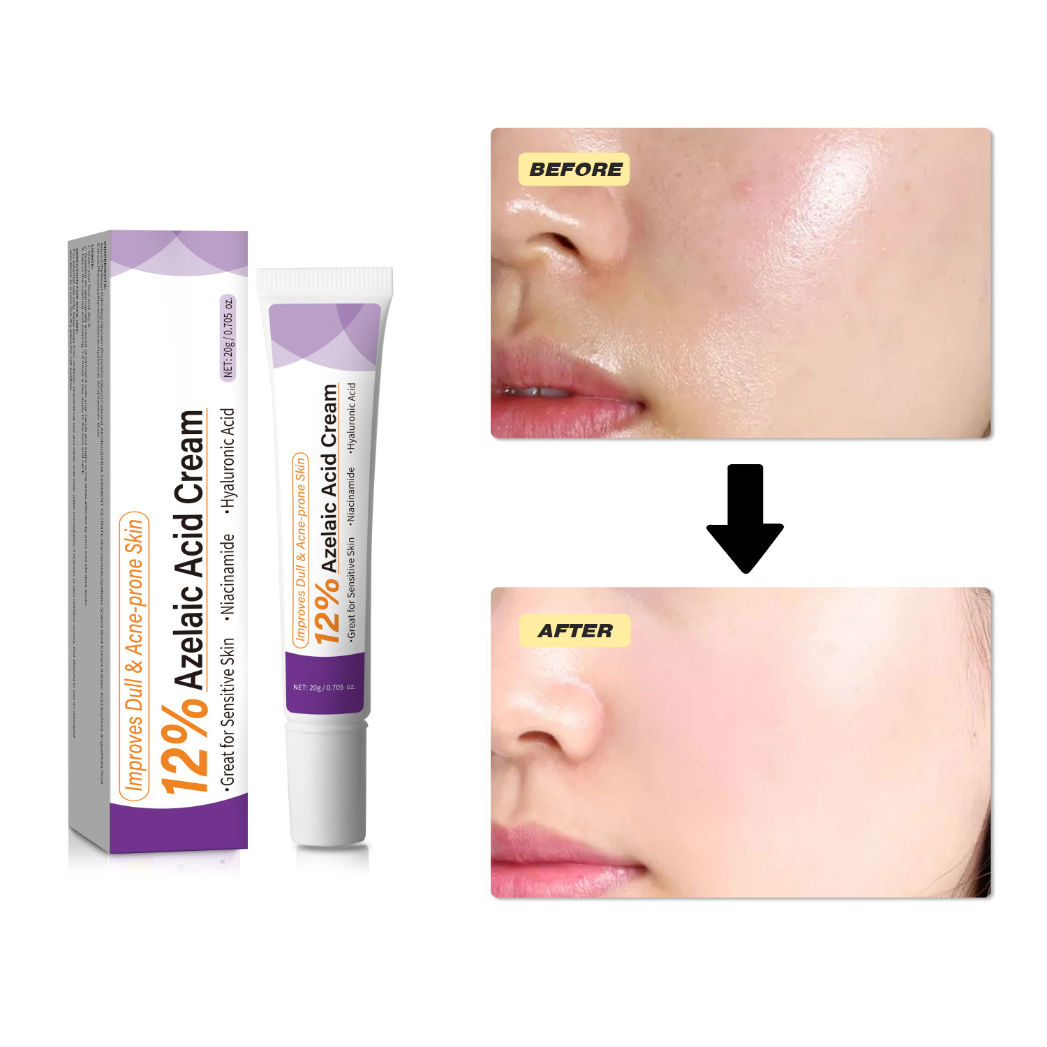 マイルドなアゼライン酸クリームは、くすんだ肌を改善し、荒れた - Skincare Skintific のレビューと価格